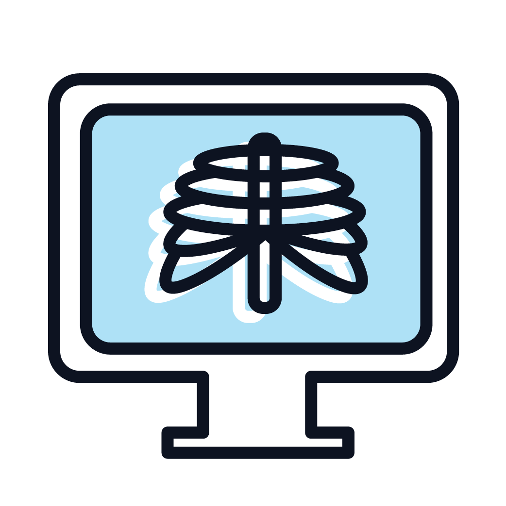 cartoon drawing of a blue PET scan machine showing the ribs