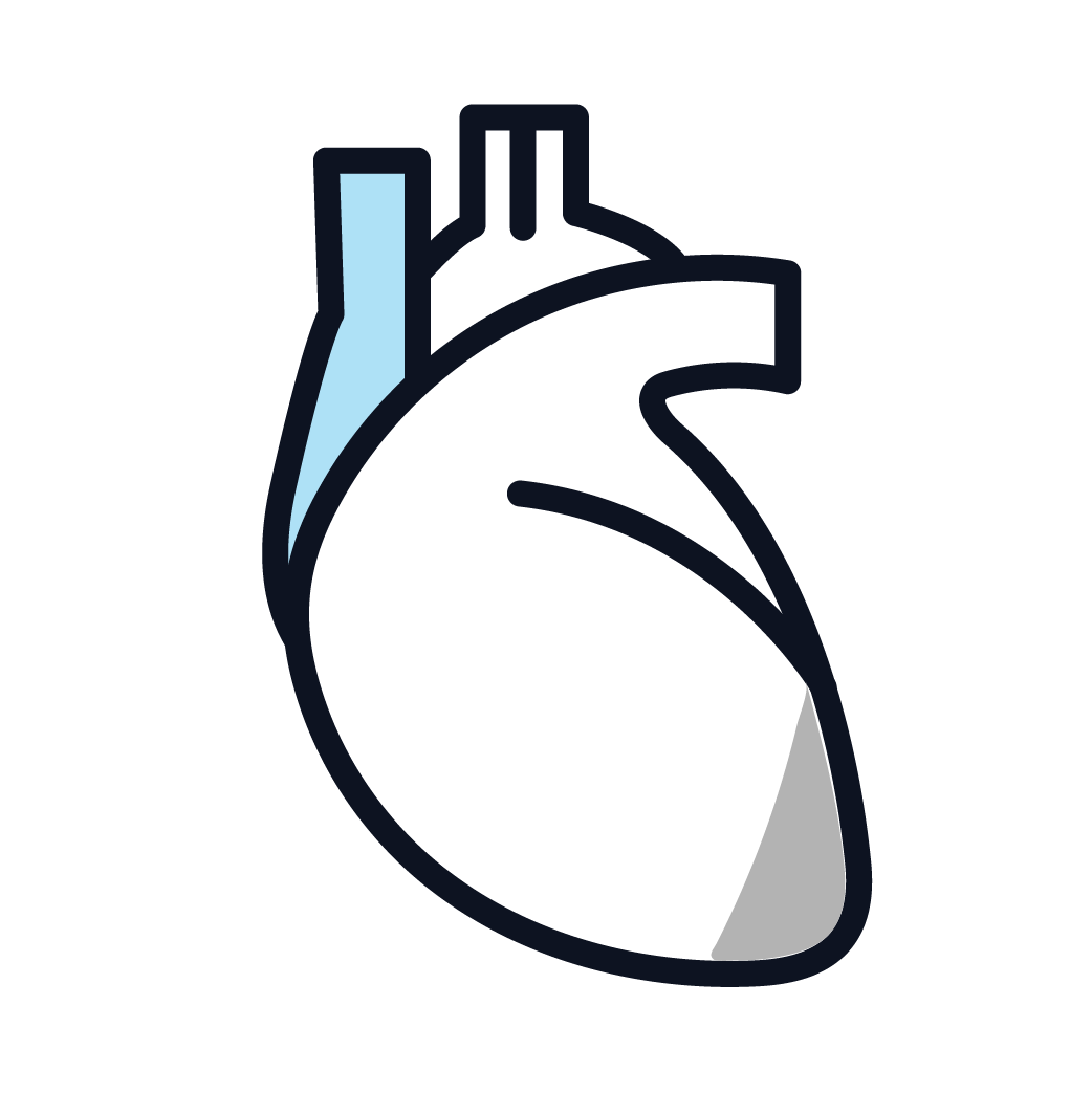 This is an image of stage 1 pericardial mesothelioma.