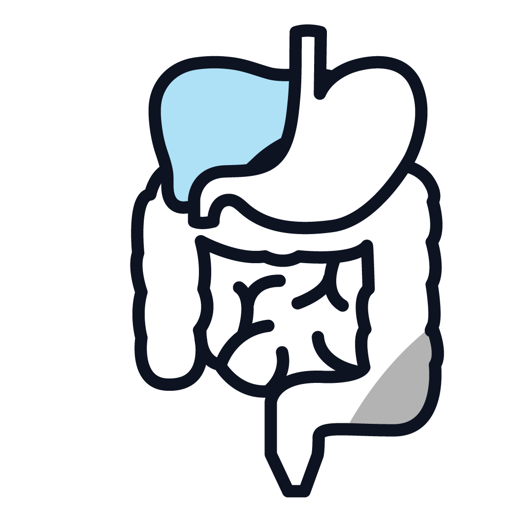 This is an image of stage 1 peritoneal mesothelioma.