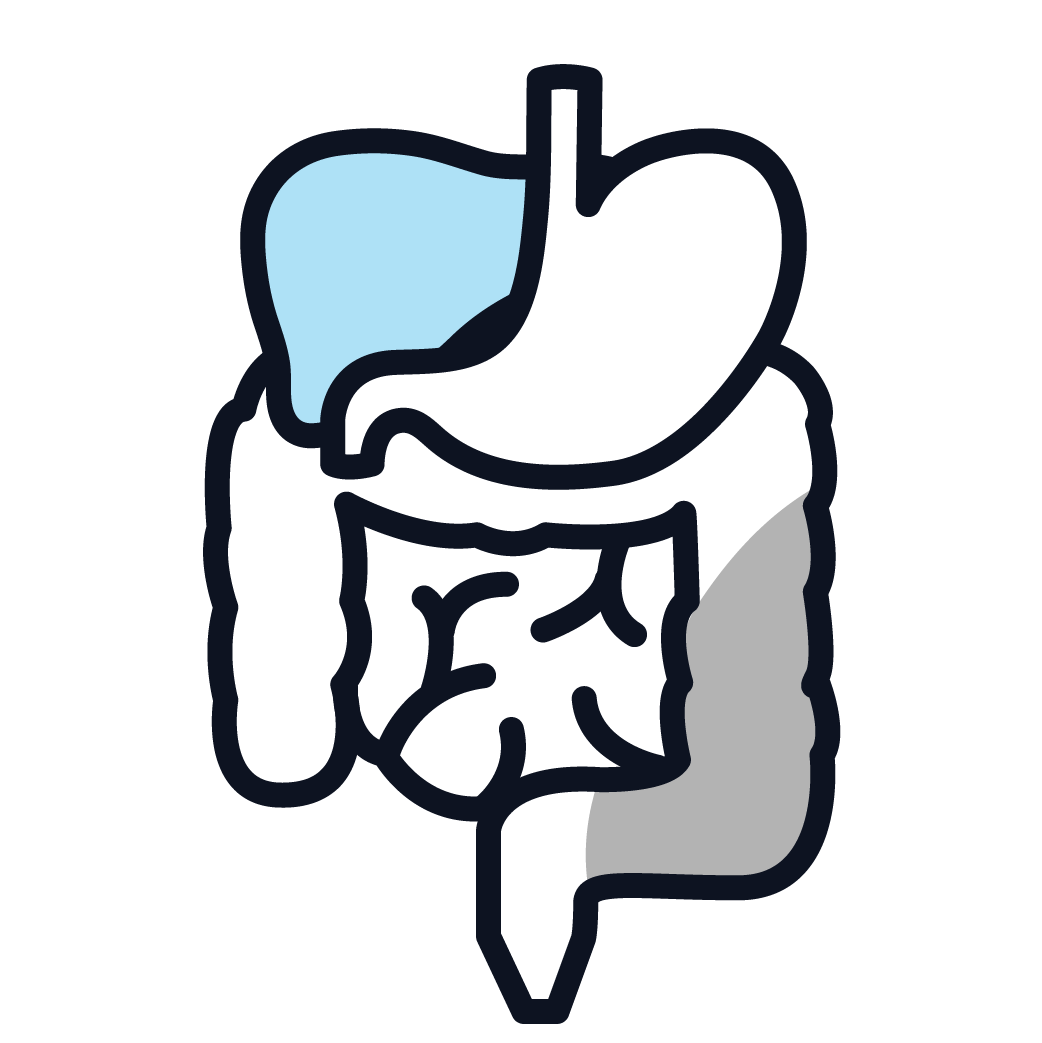 This is an image of stage 3 peritoneal mesothelioma.