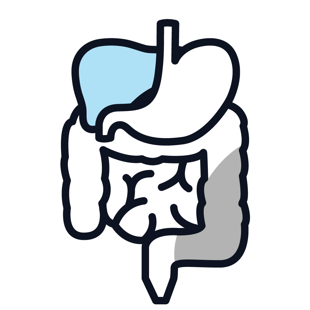 This is an image of peritoneal mesothelioma.