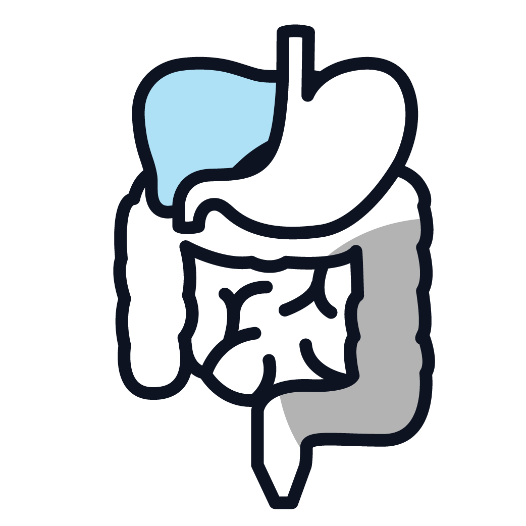 This is an image of stage 4 peritoneal mesothelioma.