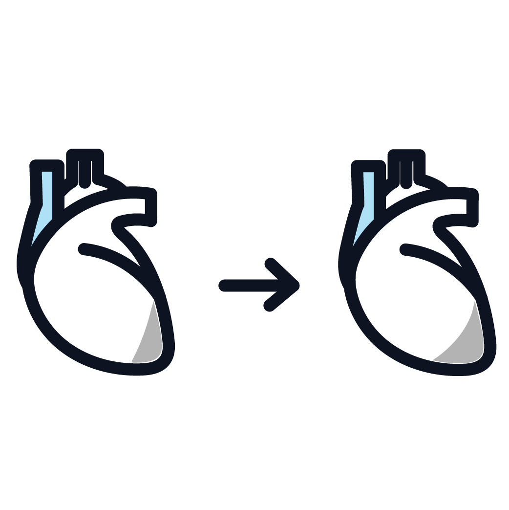 This is an image representing stages 1 and 2 mesothelioma.