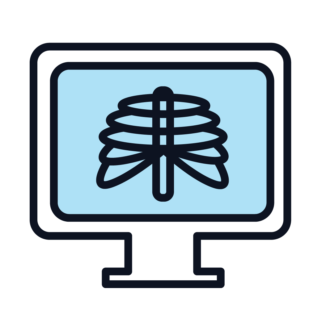 Blue drawing of an x-ray machine with ribs on the screen