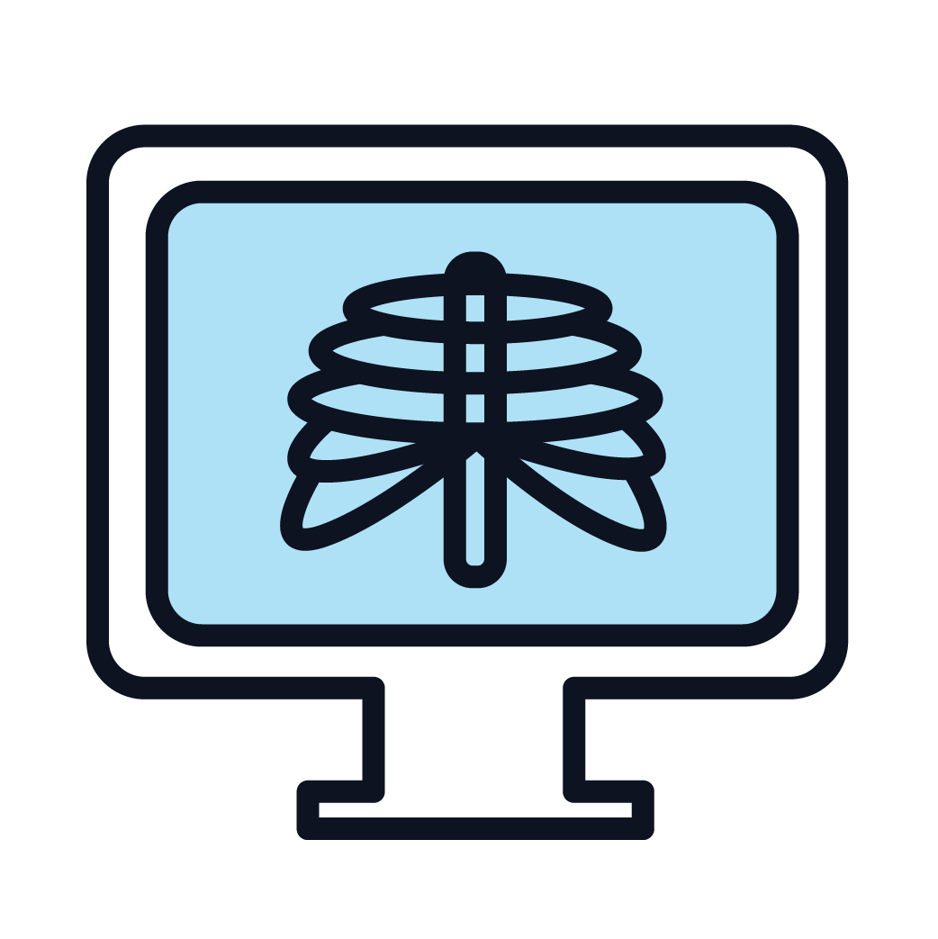 Blue drawing of an xray machine with ribs on the screen