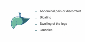 symptoms of cancer spread to liver