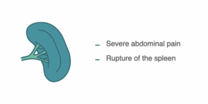 cancer spread symptoms to spleen