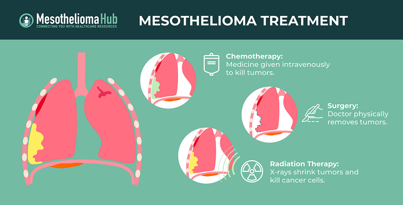 Mesothelioma treatment infographic showing chemotherapy, surgery, and radiation therapy therapies used to treat mesothelioma cancer