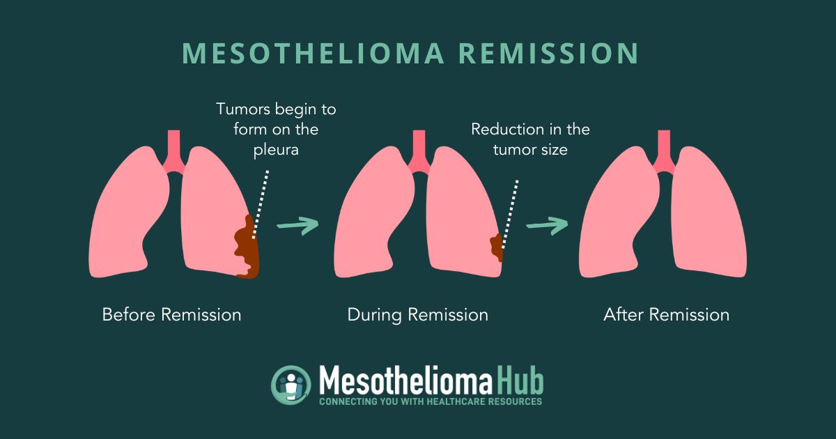 Infographic showing three sets of lungs through the three different stages of remission.